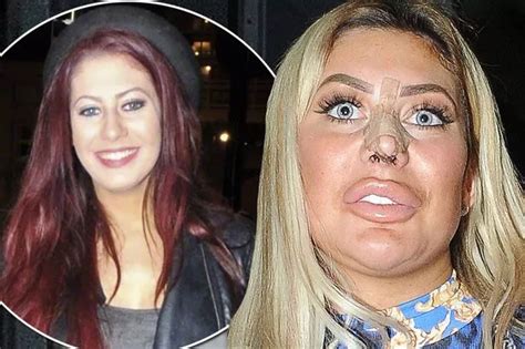 chloe ferry before and after